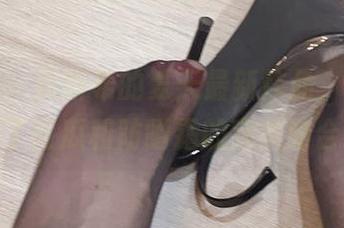 微密圈 – 周妍希的夏天最新作品，让我想到了西瓜和防晒霜的完美结合！